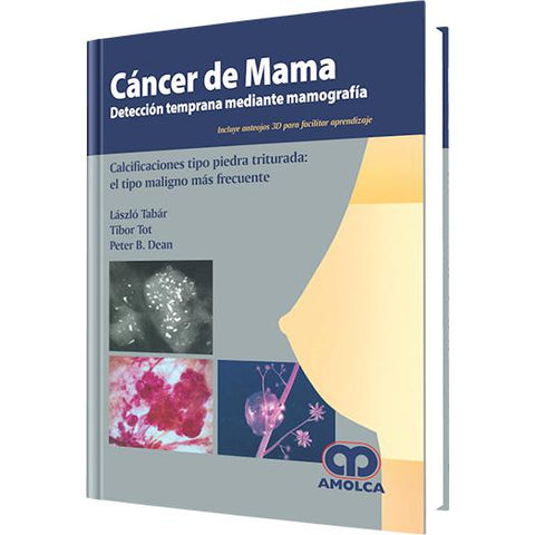 Cancer de Mama - Deteccion Temprana-REVISION - 23/01-amolca-UNIVERSAL BOOKS