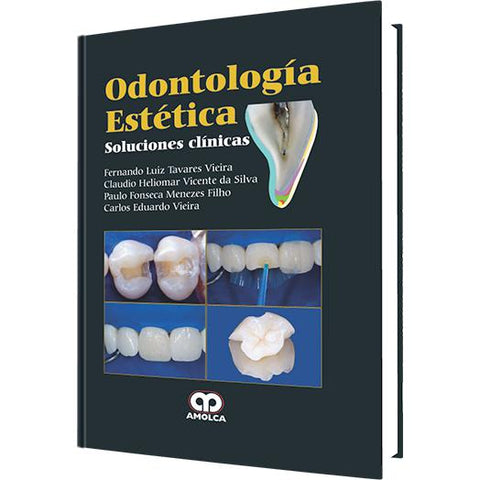 Odontologia Estetica. Soluciones clinicas-amolca-UNIVERSAL BOOKS