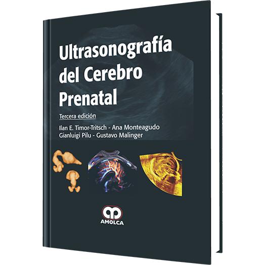 Ultrasonografia del Cerebro Prenatal-REVISION - 25/01-amolca-UNIVERSAL BOOKS