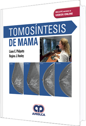 TOMOSINTESIS DE MAMA-UNIVERSAL BOOKS-UNIVERSAL BOOKS
