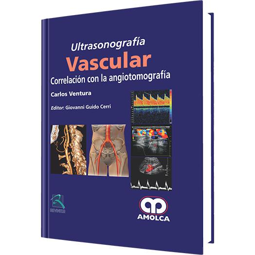Ultrasonografia Vascular Correlacion con la Angiotomografia-REVISION - 25/01-amolca-UNIVERSAL BOOKS