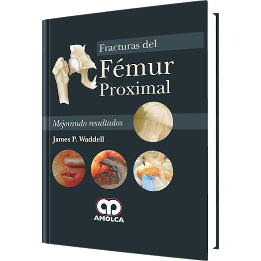 Fracturas del Femur Proximal – Mejorando Resultados-amolca-UNIVERSAL BOOKS
