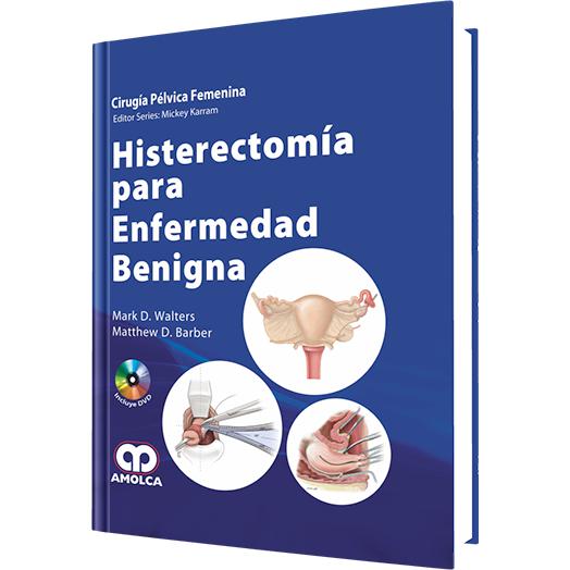 Histerectomia para Enfermedad Benigna-amolca-UNIVERSAL BOOKS