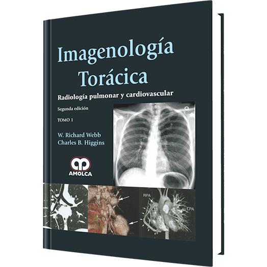 Imagenologia Toracica Radiologia pulmonar y cardiovascular - 2da Edicion - (2 tomos)-amolca-UNIVERSAL BOOKS