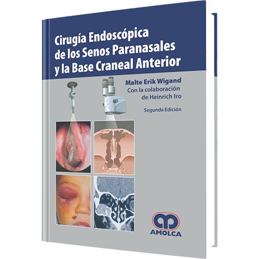 Cirugía Endoscópica de los Senos Paranasales y la Base Craneal Anterior – Segunda Edición-REVISION - 24/01-amolca-UNIVERSAL BOOKS