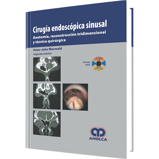 Cirugia Endoscopica Sinusal-amolca-UNIVERSAL BOOKS